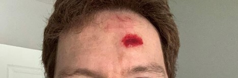 Customer scar photo from May 2021