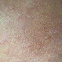 Close-up after treatment photo